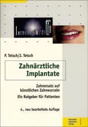 Zahnärztliche Implantate von Tetsch,  Jan, Tetsch,  Peter