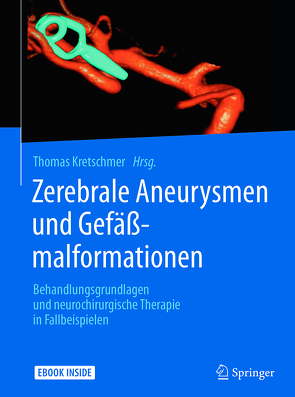 Zerebrale Aneurysmen und Gefäßmalformationen von Kretschmer,  Thomas