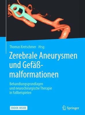 Zerebrale Aneurysmen und Gefäßmalformationen von Kretschmer,  Thomas