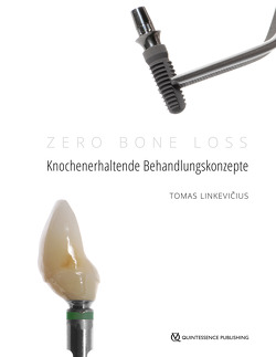 Zero Bone Loss: Knochenerhaltende Behandlungskonzepte von Linkevičius,  Tomas