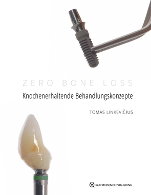 Zero Bone Loss: Knochenerhaltende Behandlungskonzepte von Linkevičius,  Tomas