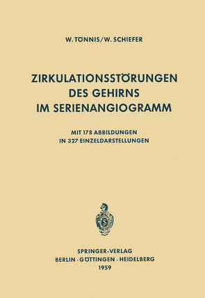 Zirkulationsstörungen des Gehirns im Serienangiogramm von Schiefer,  W., Tönnis,  W.