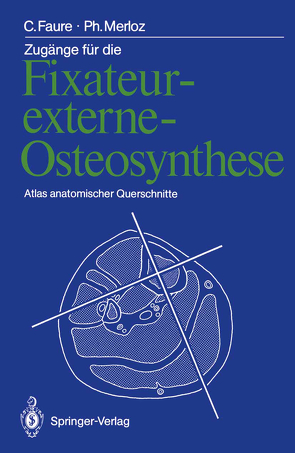 Zugänge für die Fixateur-externe-Osteosynthese von Faure,  Claude, Lederer,  Thomas, Merloz,  Philippe